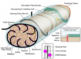 Illustration for article titled Lasers power Pentagon’s next-gen artificial limbs